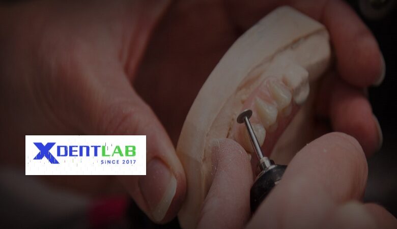 Vietnam dental laboratories District 6 Ho Chi Minh