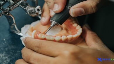 Removable Denture Lab District 7 Ho Chi Minh