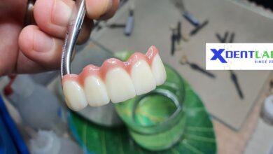 Vietnam dental lab district 1 Ho Chi Minh