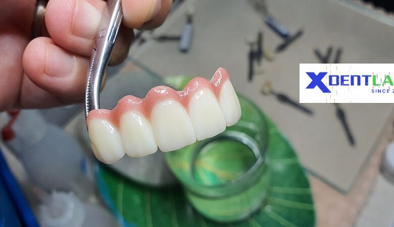 Vietnam dental lab district 1 Ho Chi Minh
